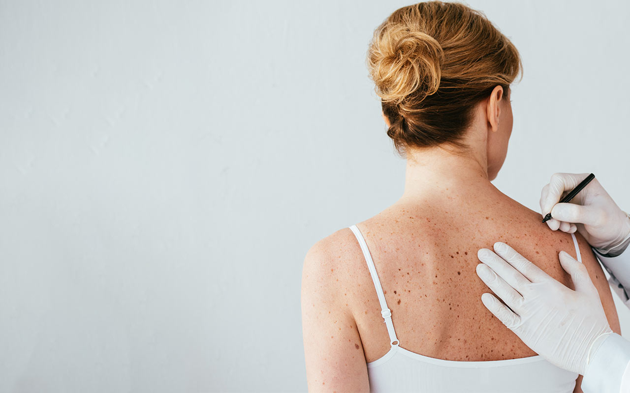 hautzentrum-dr-dirting-hanau