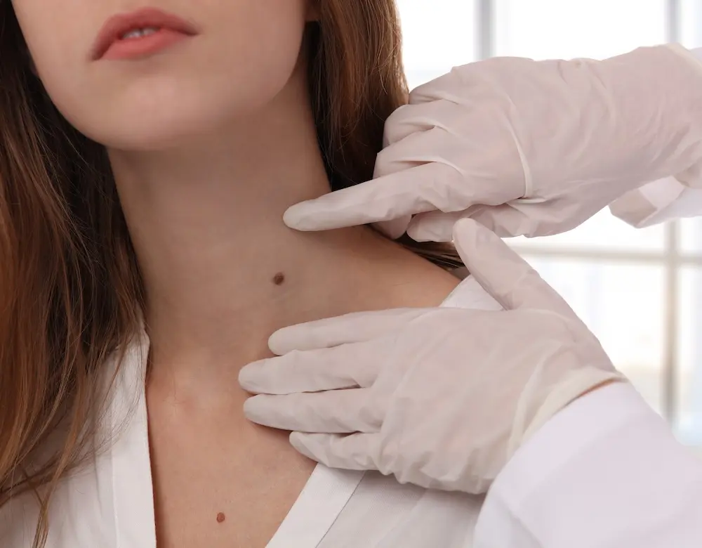 Eine Frau mit auffälligem Leberfleck am Hals wird untersucht, Link zur Seite Dermatochirurgie
