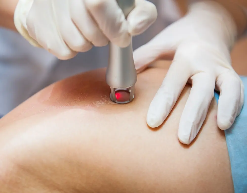 Ein Laser wird auf die Haut aufgesetzt, Link zur Lasertherapie
