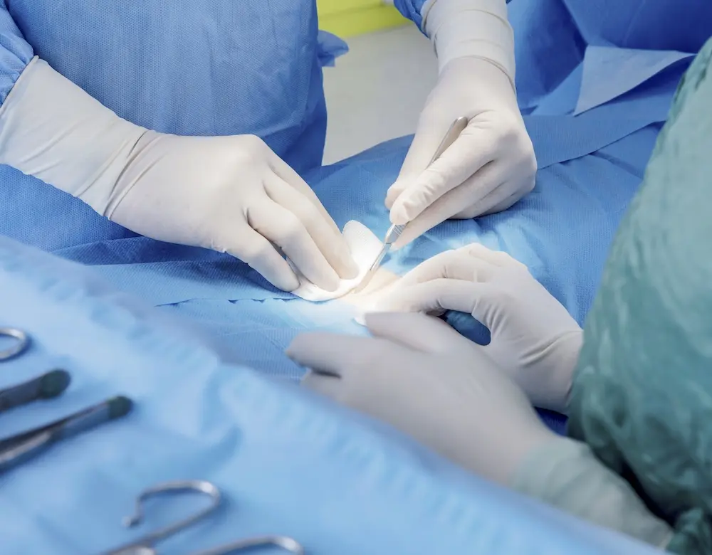 Ein Patient wird operiert, weiter zu Tumorchirurgie